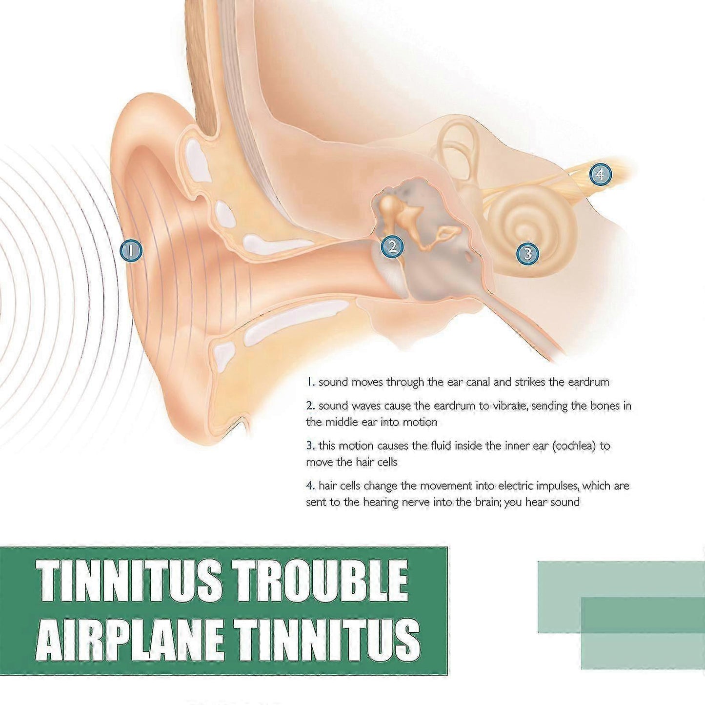 SOUTHMOON TINNITUS RELIEF SPRAY FOR EAR TREATMENT